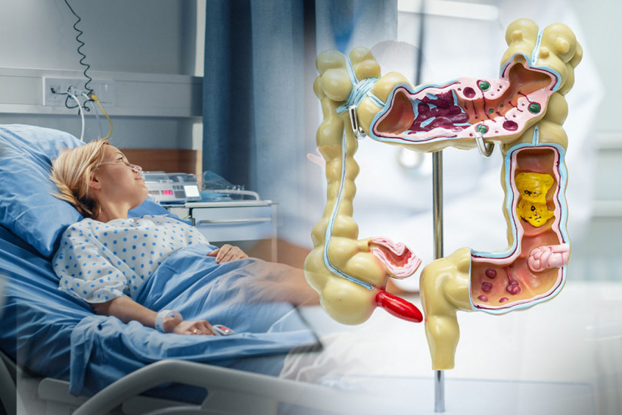 ŽALILA SE NA BOL U STOMAKU I MUČNINU, LEKARI MISLILI DA IMA UPALU SLEPOG CREVA: Hirurzi se zgrozili kad su videli šta se KRILO u njenom abdomenu