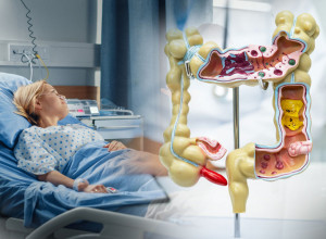 ŽALILA SE NA BOL U STOMAKU I MUČNINU, LEKARI MISLILI DA IMA UPALU SLEPOG CREVA: Hirurzi se zgrozili kad su videli šta se KRILO u njenom abdomenu