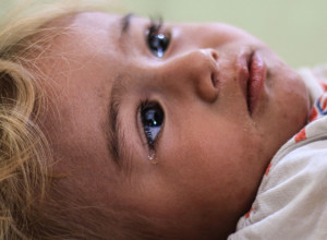 OD OVE VRSTE RAKA OBOLEVA SVE VIŠE MLADIH: Alaramantno je - a uzrok bi mogla da bude zaraza iz detinjstva!