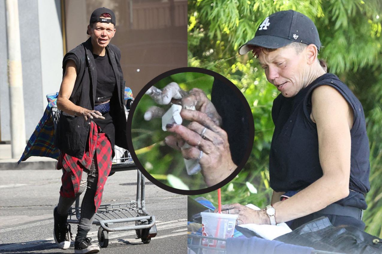 NOVE POTRESNE FOTOGRAFIJE NEKADA ATRAKTIVNE GLUMICE ŠOKIRALE SU SVET: Sada je potpuno ostala bez zuba i bez kose, tumara ulicama i NEPREPOZNATLJIVA JE! (FOTO)