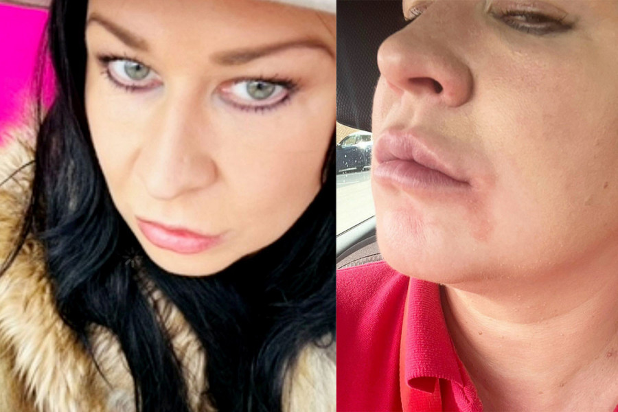 USELILA SE SA ĆERKOM U NOVI STAN I UBRZO JE GLAVA POČELA DA JOJ OTIČE: Mislila je da će joj lice eksplodirati, a onda je videla šta joj raste na krevetu - da se naježiš! (FOTO)