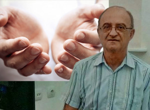 DR KAMENOV UPOZORAVA: POGLEDAJTE DLANOVE I VRHOVE PRSTIJU, ovo je prvi znak da ste u opasnosti! A evo kako ćete prepoznati osobu propalog imuniteta - hitno izbacite kravlje mleko!