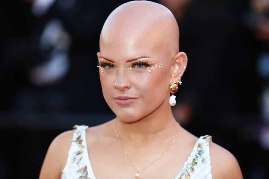 TRPELA JE ZASTRAŠUJUĆE MALTRETIRANJE, A SADA JE ZVEZDA CRVENOG TEPIHA! Pojavila se bez kose na Kanskom festivalu i privukla sve poglede! (FOTO)