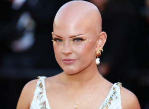 TRPELA JE ZASTRAŠUJUĆE MALTRETIRANJE, A SADA JE ZVEZDA CRVENOG TEPIHA! Pojavila se bez kose na Kanskom festivalu i privukla sve poglede! (FOTO)