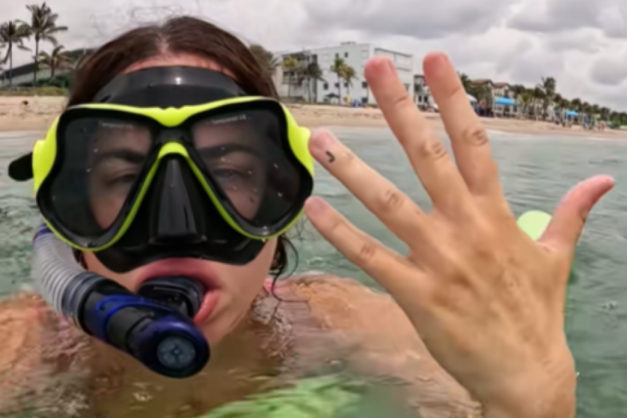 IZGUBILA JE BURMU TOKOM RONJENJA: "Bila sam očajna, muž je godinama štedeo za nju - rešila sam da rizikujem!" (VIDEO)