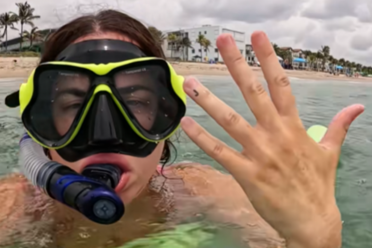 IZGUBILA JE BURMU TOKOM RONJENJA: "Bila sam očajna, muž je godinama štedeo za nju - rešila sam da rizikujem!" (VIDEO)