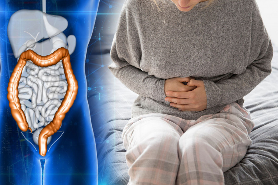 NOVO OTKRIĆE! Jedna navika povećava šanse za preživljavanje raka debelog creva, a prvi simptom vidi se u stolici