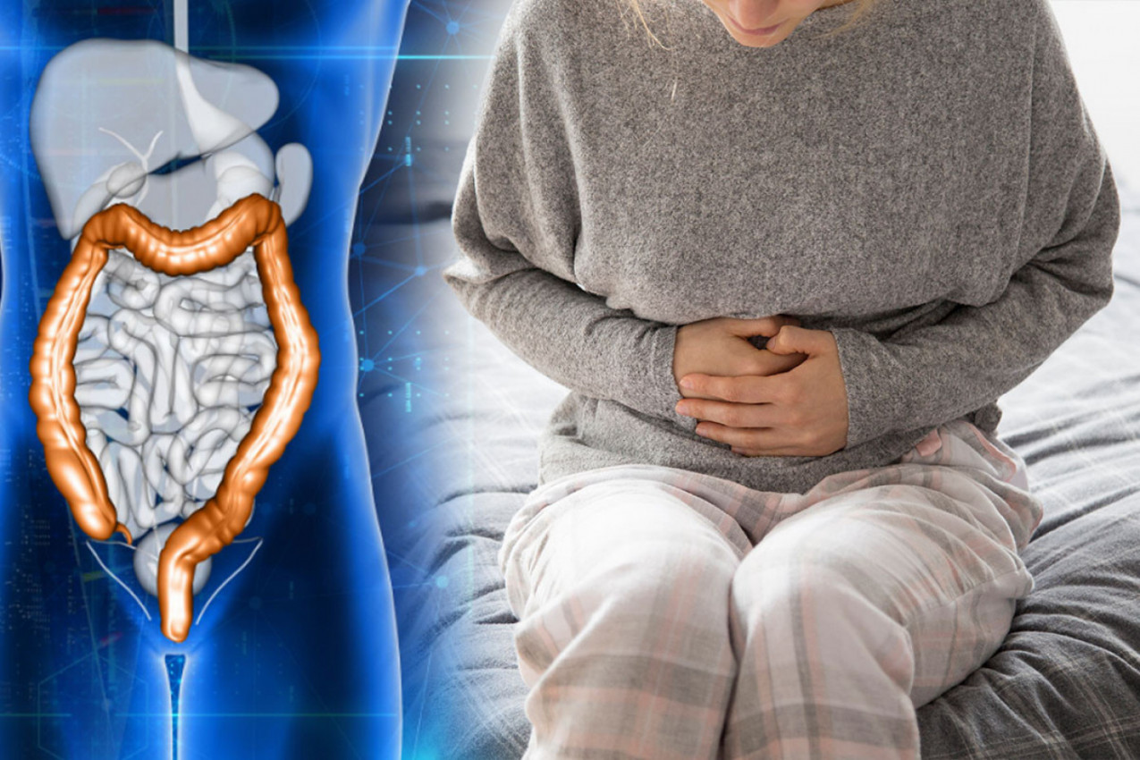 NOVO OTKRIĆE! Jedna navika povećava šanse za preživljavanje raka debelog creva, a prvi simptom vidi se u stolici