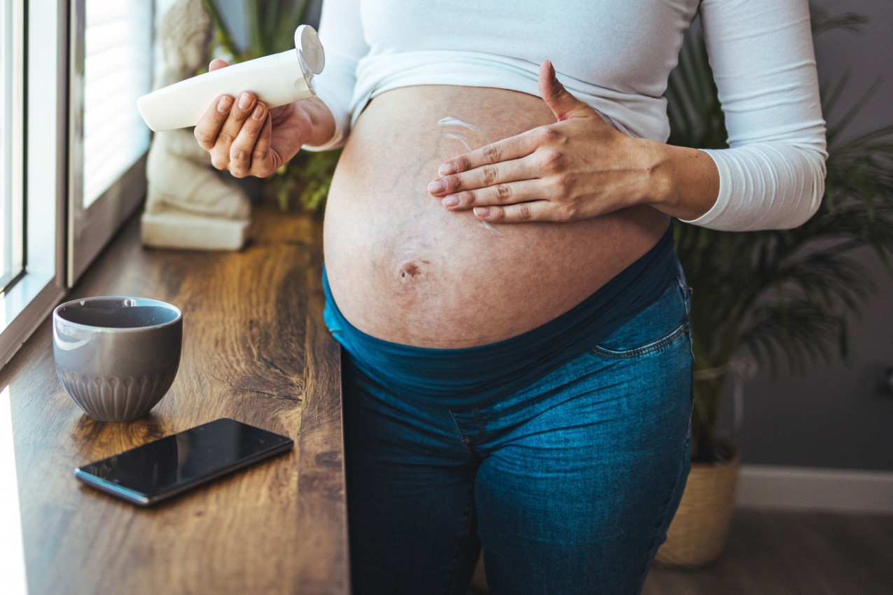 STRIJE MOGU ZAUVEK OSTAVITI TRAG NA VAŠOJ KOŽI: Evo kako da ih zaustavite na vreme