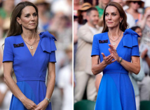 KEJT MIDLTON  NE LIČI NA SEBE, IMA SAMO 41 KILOGRAM, NJENO TELO VIŠE NE MOŽE DA IZDRŽI: Nove slike rastužile javnost, ovo je istina o njenom zdravlju (FOTO)