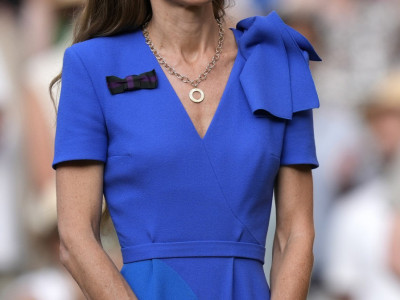 Ovako izgled Kejt Midlton nakon borbe sa rakom