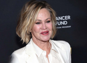 ZVALI SU JE NAJVEĆOM HOLIVUDSKOM KATASTROFOM PLASTIČNE HIRURGIJE: Povadila je sve filere i u 69. godini kaže da sada izgleda "normalno" (FOTO)