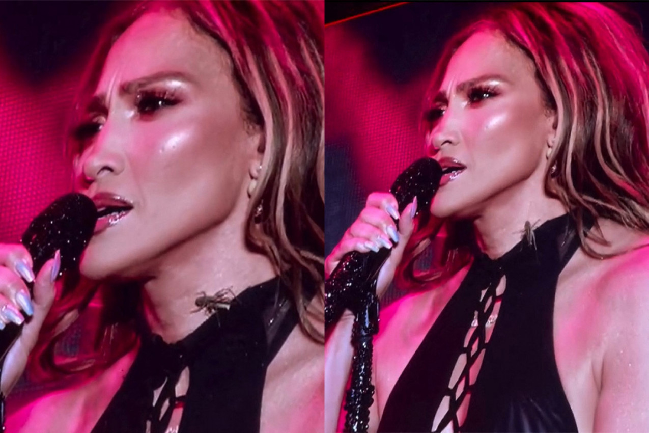 Dženifer Lopez pokazala šta znači profesionalizam: Pevala s bubom na vratu i nije ni trepnula