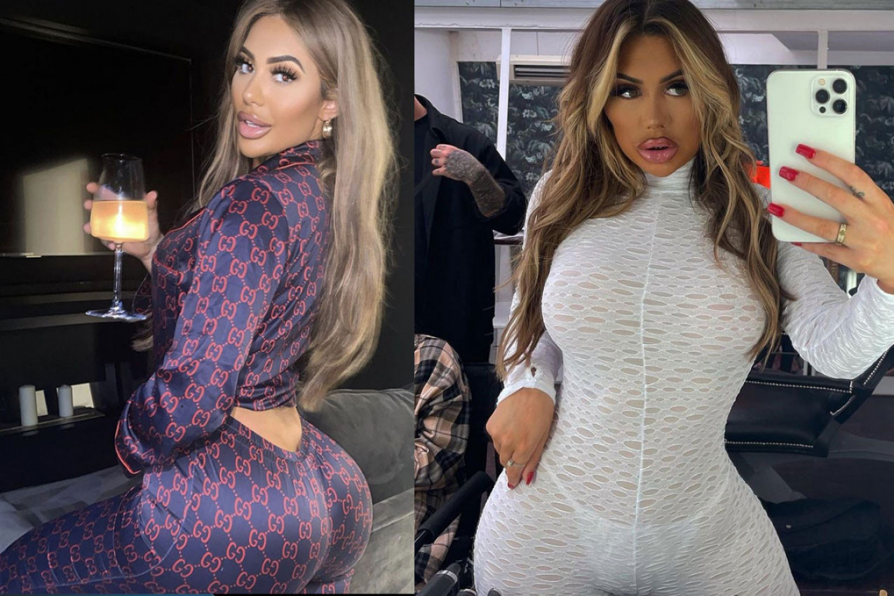 RIJALITI-ZVEZDA U OČAJU URADILA BRAZILSKO PODIZANJE ZADNJICE: Bila sam još nesrećnija time, morala sam to da uklonim sa sebe! (FOTO)