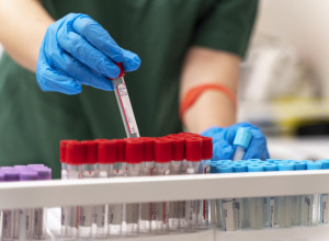 PRIRODNI napitak koji je bomba za KRVNU SLIKU: Ako se borite sa anemijom, tri kašike dnevno ove smese napraviće razliku