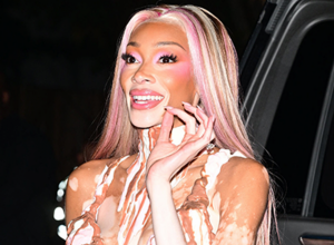 Ovo je MOĆAN kostim kojim je Vini Harlou posramila sve koji joj se rugaju zbog vitiliga