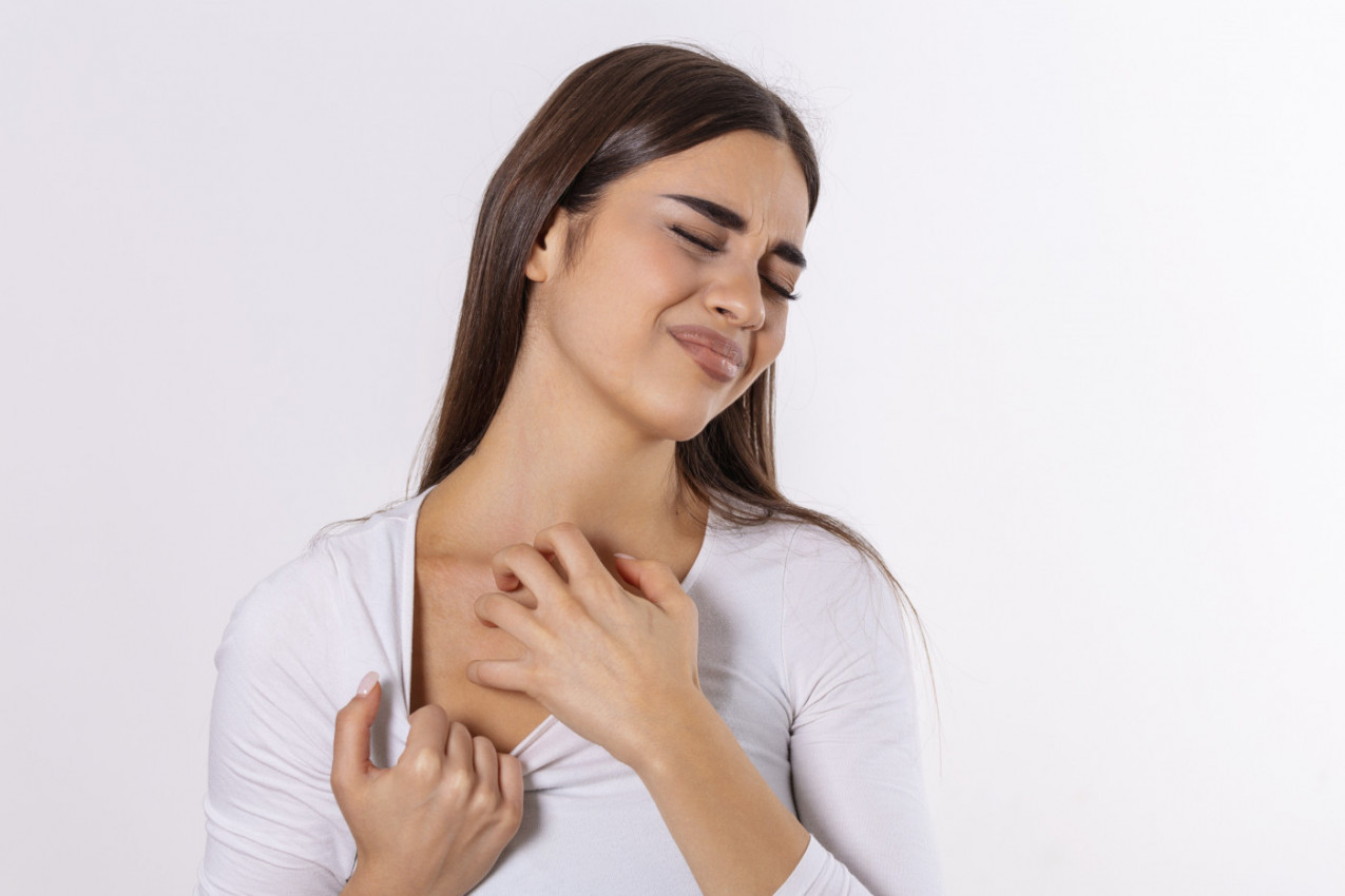 Nije svaka koprivnjača znak alergije: 3 znaka da prepoznate OSIP koji je izazvan STRESOM