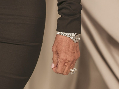 Znaci starenja vide se na ruci