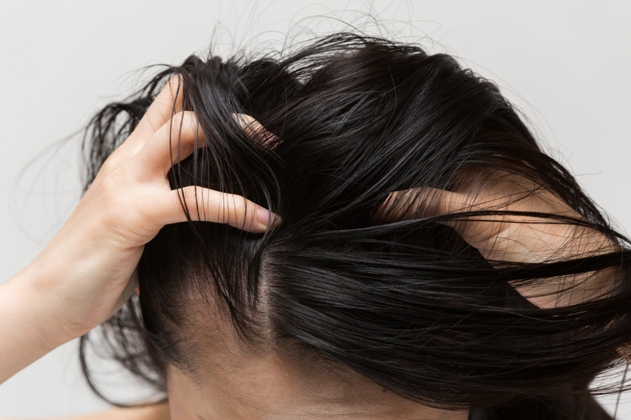 Zašto nas SVRBI TEME i kako da ga smirimo: Stručnjaci otkrivaju najčešće uzroke problema sa kožom glave