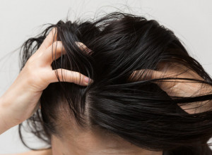 Zašto nas SVRBI TEME i kako da ga smirimo: Stručnjaci otkrivaju najčešće uzroke problema sa kožom glave