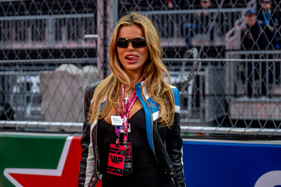 Manekenka koju su prozivali da liči na Majkla Džeksona izvadila filere i postala PRIRODNA: Transformacija je NEVEROVATNA