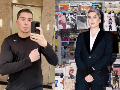 Šest puta je operisao nos, radio je zahvate na kapcima, fejslifting, podizanje obrva, zatezanje kože oko očiju, korekcije zuba, kao i injekcije za posvetljivanje tena