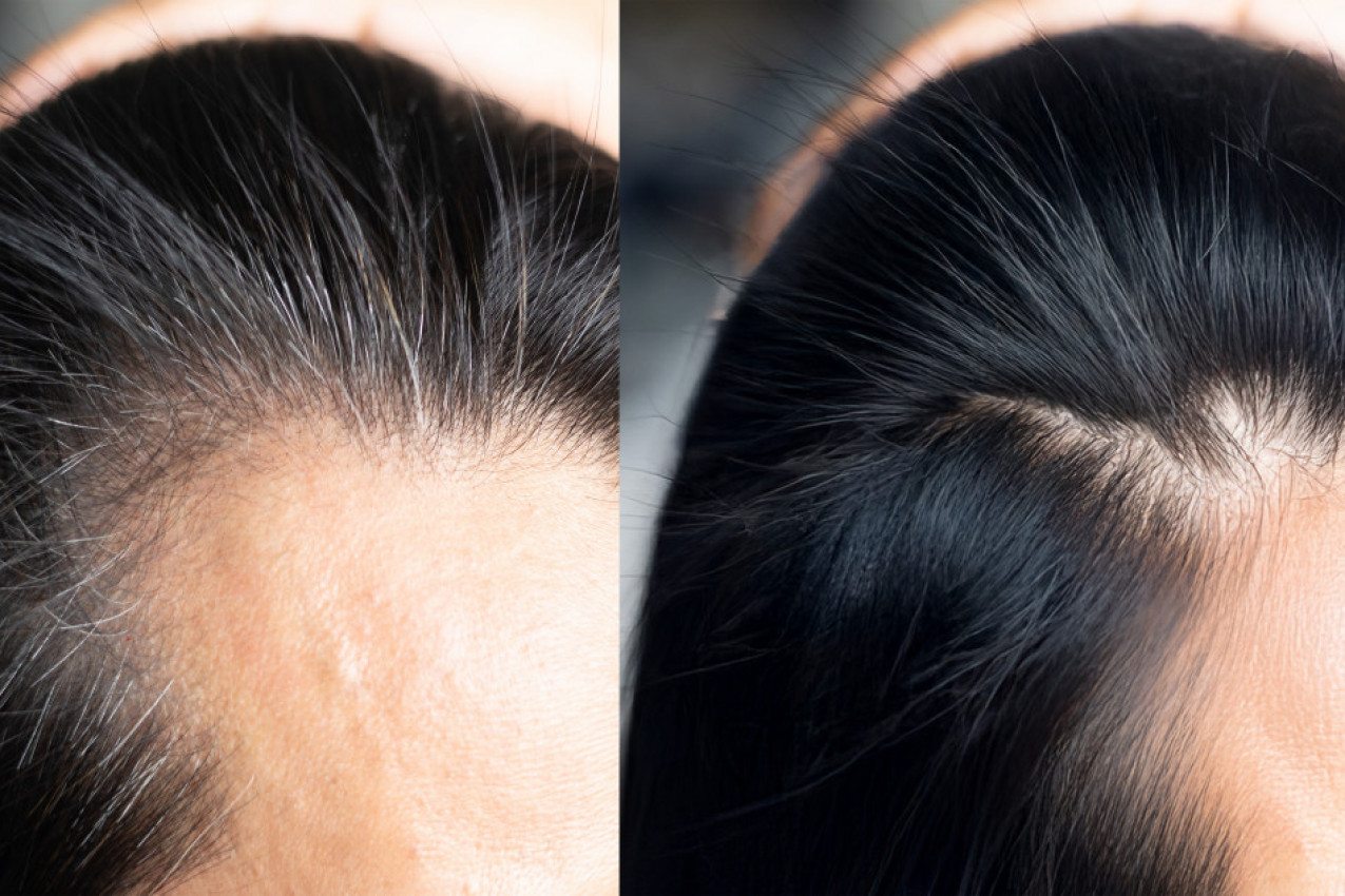 Može li seda kosa ponovo postati crna? Stručnjak objašnjava