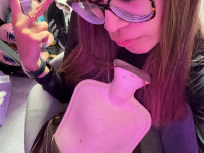 Sada je ozbiljno opekla kožu