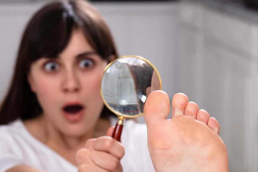 Vaši nožni prsti mogu da otkriju mnogo o zdravlju: Obratite pažnju na ovih 8 promena - ne ignorišite ih!