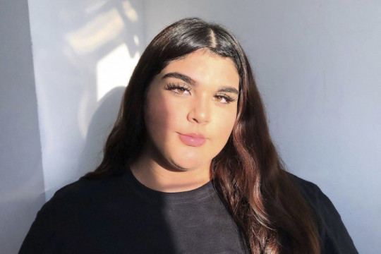 Niko ovu devojku više ne može da prepozna: SMRŠALA je 40 kilograma, a umesto podrške dobila optužbe da vara! (FOTO)