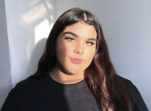 Niko ovu devojku više ne može da prepozna: SMRŠALA je 40 kilograma, a umesto podrške dobila optužbe da vara! (FOTO)