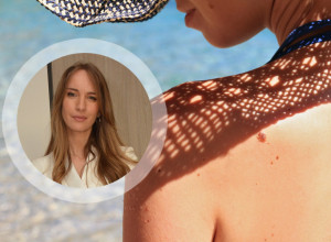 Dermatolog dr Bojana Novović upozorava: Ova greška sa suncem uništava kožu već u proleće – većina ljudi je pravi svakog dana