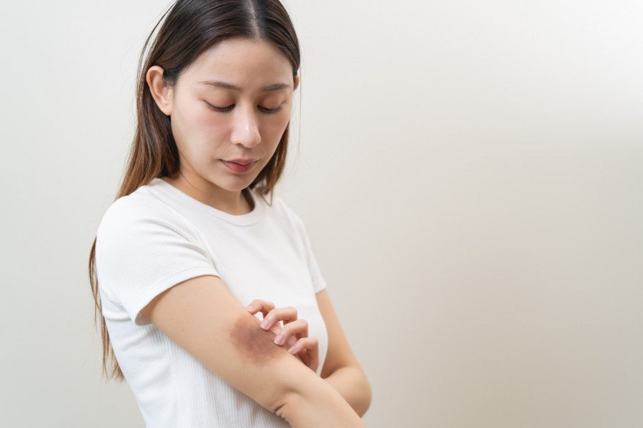 Kad god se pogledate uočite MODRICU? Evo kada je to bezazleno, a kada znak za uzbunu