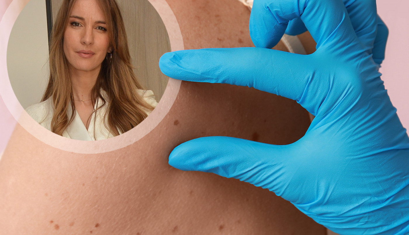 Dr Bojana Novović, dermatovenerolog: Jedna promena na MLADEŽU može biti opasna – proverite da li ste u riziku!