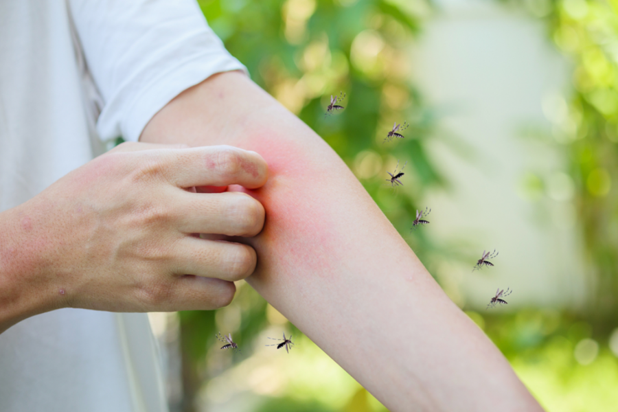 Svrbi vas ujed komarca? Godinama radimo jednu veliku grešku – evo šta zaista pomaže, a šta samo pogoršava problem