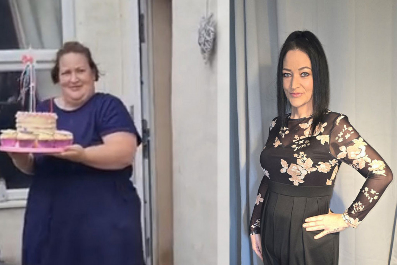 Smršala 72 kg za godinu dana i to bez vežbanja – evo kako je to uspela