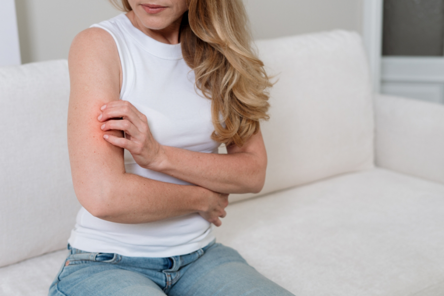Psorijaza može da se POGORŠA I LETI: Dermatolog otkriva koje greške najčešće izazivaju nove promene na koži