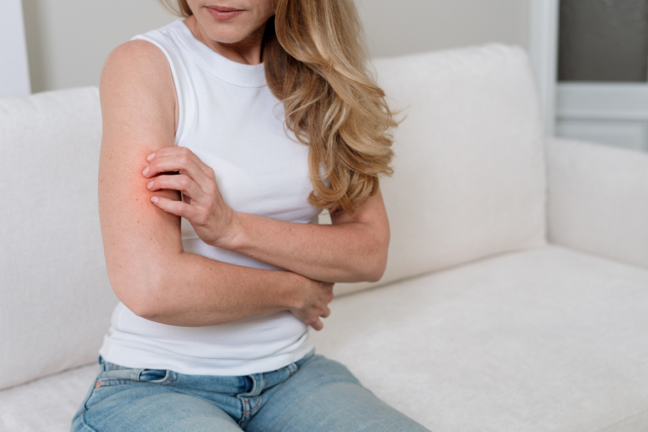 Psorijaza može da se POGORŠA I LETI: Dermatolog otkriva koje greške najčešće izazivaju nove promene na koži