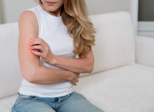 Psorijaza može da se POGORŠA I LETI: Dermatolog otkriva koje greške najčešće izazivaju nove promene na koži